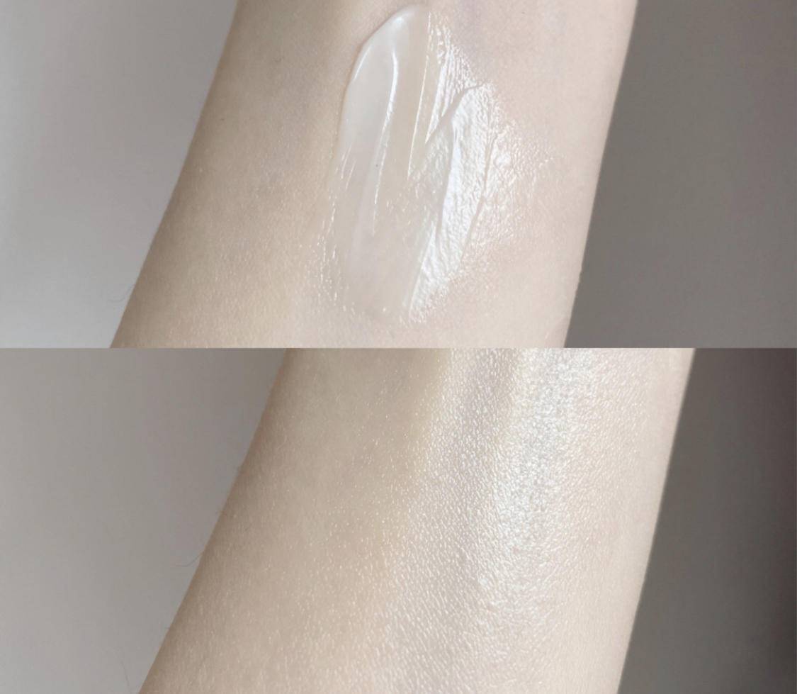 痘痘痘印的正确处理方法,痘痘留下的痘印应如何正确处理