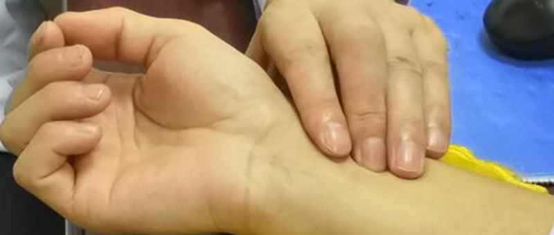 前列腺炎案例处方,治疗前列腺炎和女性漏尿的偏方