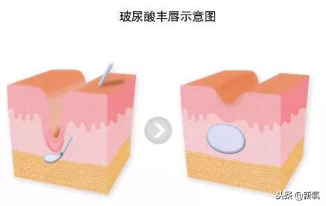 辛芷蕾是苦相女生吗,辛芷蕾气质怎么养成