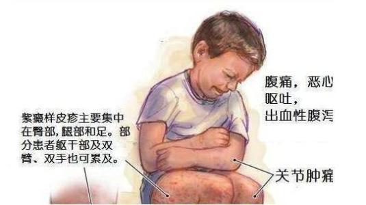过敏性紫癜小红点会痒吗,不痛不痒的小红点是什么紫癜