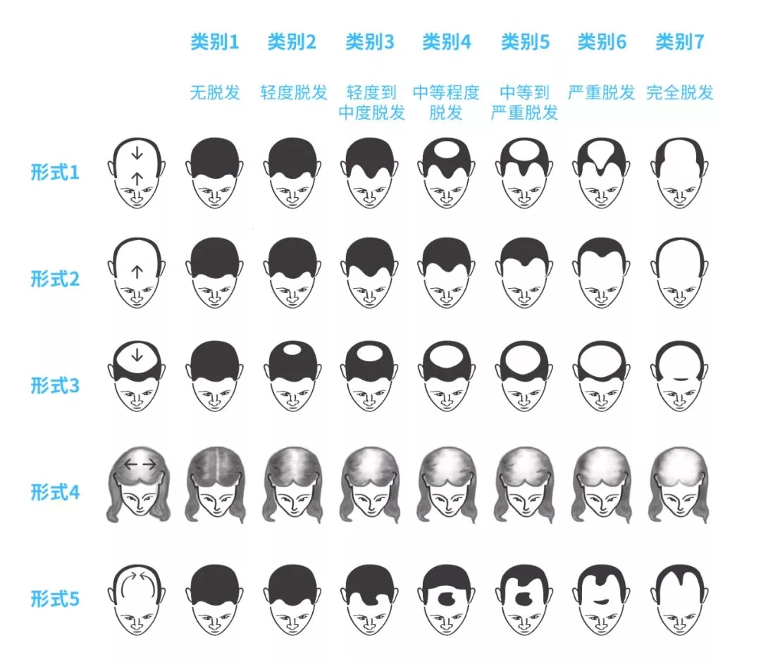 头发越来越少是什么原因,头发原来很多为什么现在越来越少