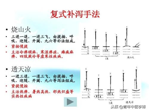 烧山火与透天凉补泻手法精髓,烧山火透天凉手法讲解