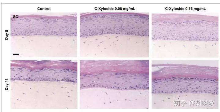 欧莱雅哪款眼霜中含玻色因,欧莱雅哪款含了玻色因高