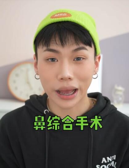 美妆网红晒华晨宇变脸过程质疑其做了3项整容手术，真的不怕被告