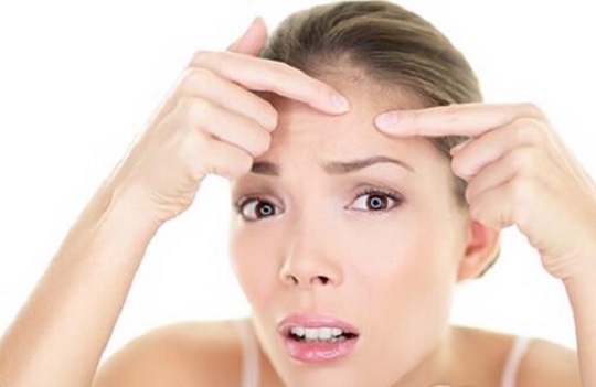 祛痘后开始爆痘原因有哪些,易长痘怎么祛痘痘小妙招