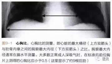 胸侧位正位片可以检查出什么,胸部正位侧片是测什么的