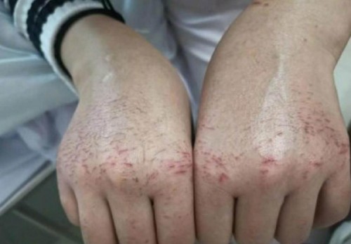 手上皮肤怎么护理,如何护理手背皮肤