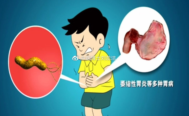 萎缩性胃炎可逆转吗吃什么药,慢性萎缩性胃炎c3可以逆转吗