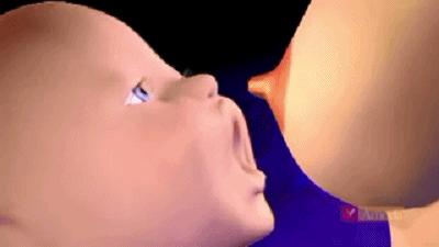 涨奶堵奶有硬块红肿最快的办法,乳房堵奶红肿怎么样算好了