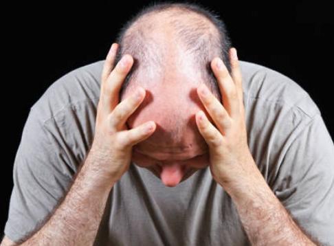 南昌第12医院植发靠谱吗,南昌植发机构的毛囊从哪来