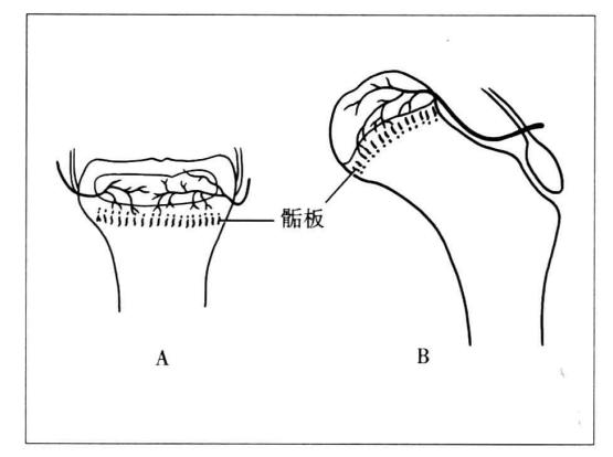小孩腿部骨折后对身高有影响么,孩子骨折会影响身高吗