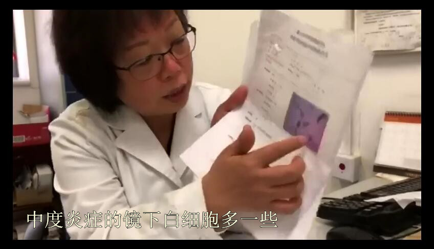 1618阳性tct轻度炎症会是宫颈癌吗,宫颈癌筛查tct检查有炎症