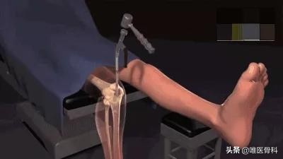 如何练成大长腿女神必看,如何练成又细又长的大长腿