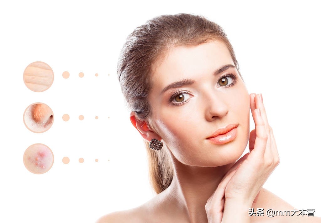 女性脸上长斑原因,30岁女性脸上开始长斑点什么原因