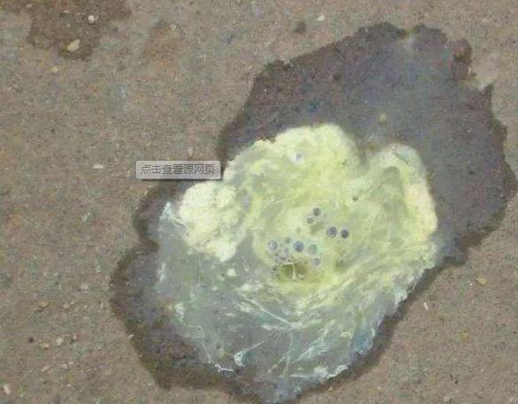 大肠杆菌是怎么产生的,如何治疗大肠杆菌最好的方法