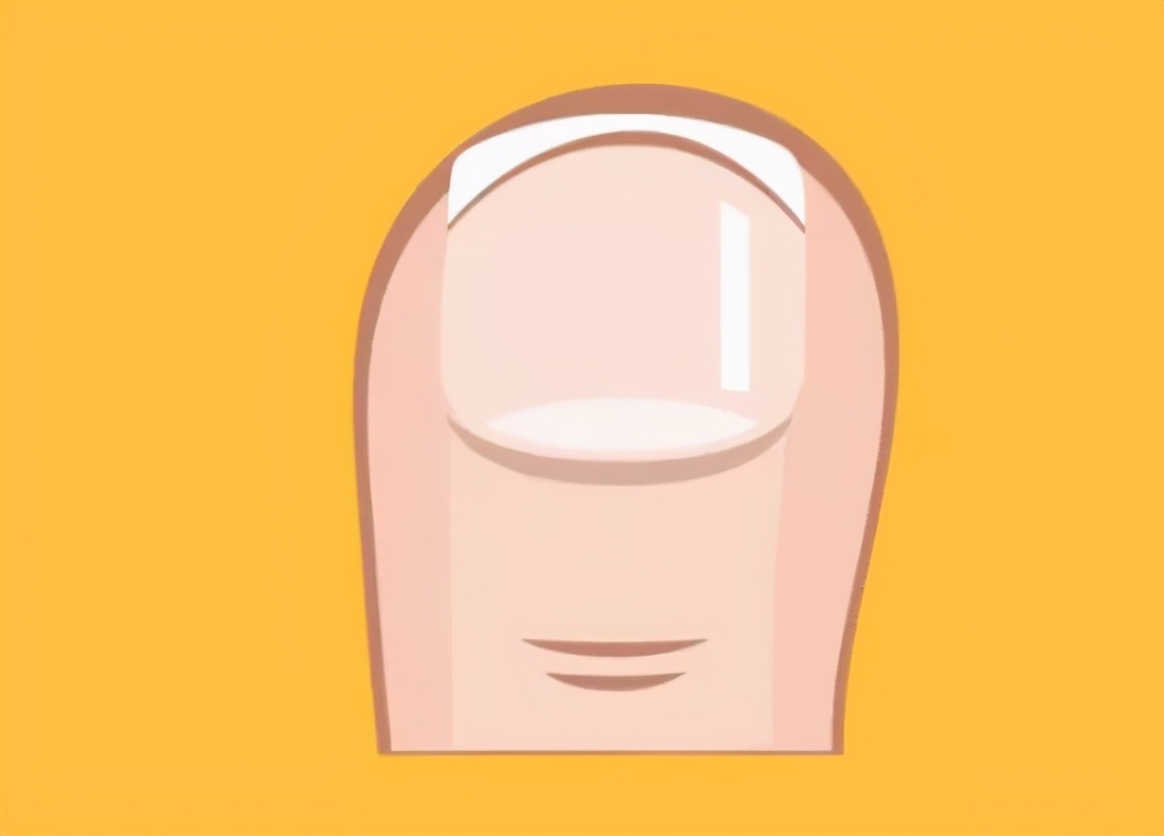 你会正确剪脚指甲么,修剪指甲正确的方法