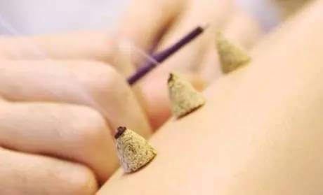 热证可灸和热证禁灸,热证可以用灸法治疗吗