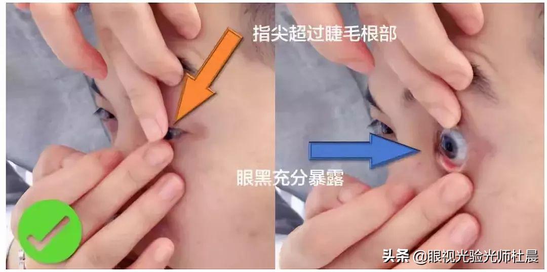 初次戴隐形眼镜有刺痛感,戴隐形眼镜时应注意哪些事项