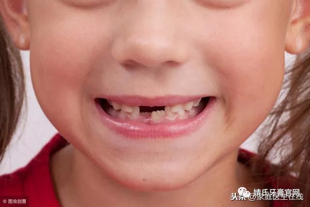 宝宝牙膏防蛀和防龋齿怎么选,宝宝牙膏含氟1-3岁防蛀牙秘方