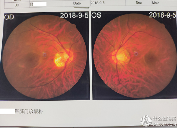 网上买的眼镜怎么配镜,在网上买镜框眼镜店里配镜靠谱吗