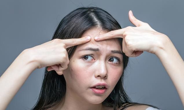 祛痘印方法大放送,十个流行的祛痘印小偏方