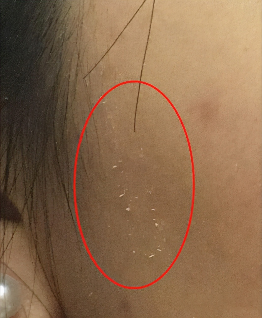 为啥要去脸部角质,为什么要去皮肤上的角质