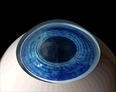 小心激光近视手术：近期数十人因此丧命，多名加拿大人受虐