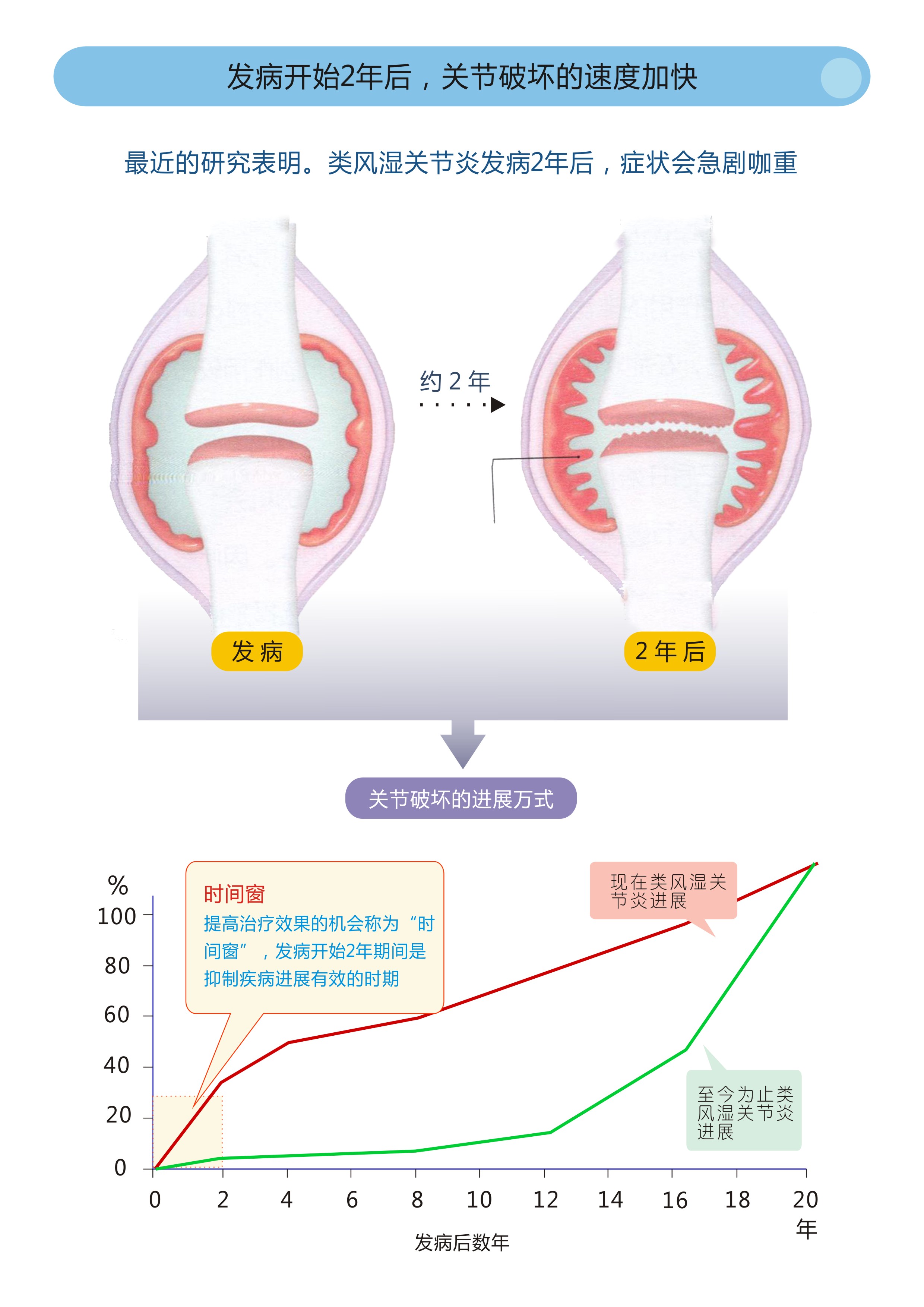类风湿关节炎早期发现治疗能好吗,早期类风湿关节炎彻底治愈率