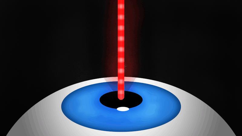 近视眼激光手术有风险吗,激光近视眼手术十大危害