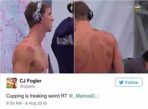 蚊帐成天价抢手货,拔罐变灵丹妙药,在外国人眼里,中国这么牛