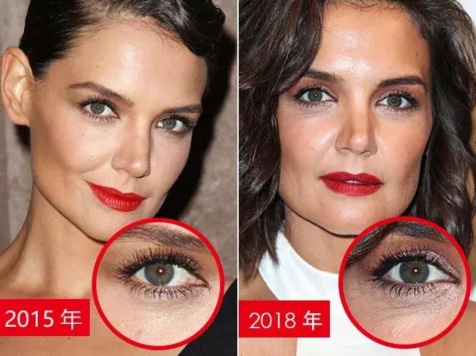 大笑不会长皱纹的方法,大笑没有法令纹