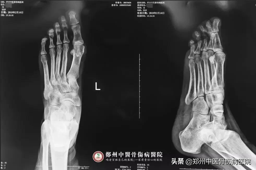 她辗转多家医院治疗未见好转,终在这里成功解除病痛!