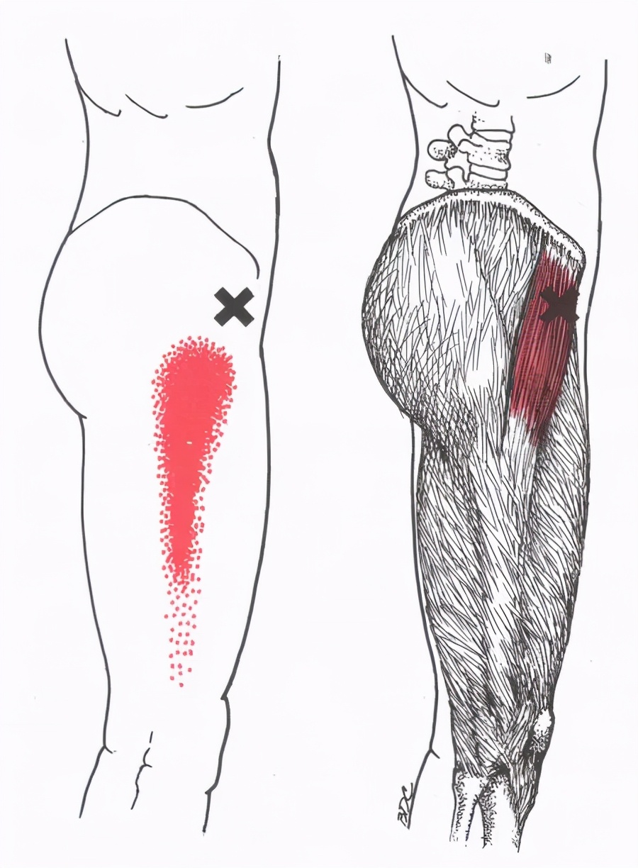 康复训练手法干货分享,康复治疗师肌肉