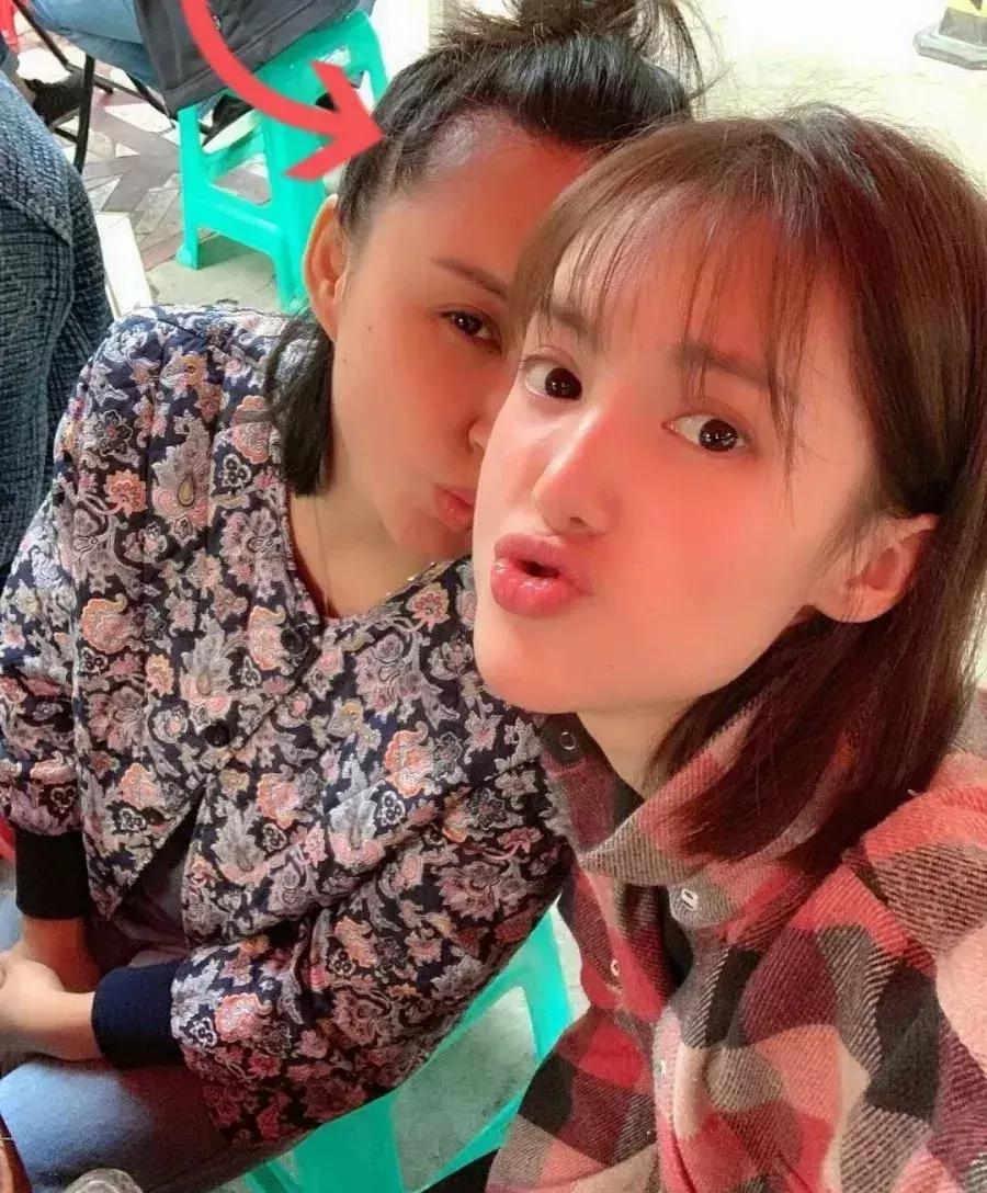 90后的秃头危机,90后开始秃头了每天坚持一个动作