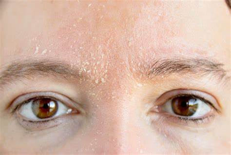 面部痒红肿怎么回事,皮肤瘙痒身上三处发痒要当心了