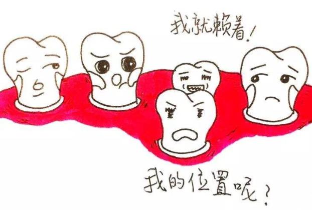 双排牙乳牙松动了还需要拔吗,一岁半宝宝长双排牙要拔吗