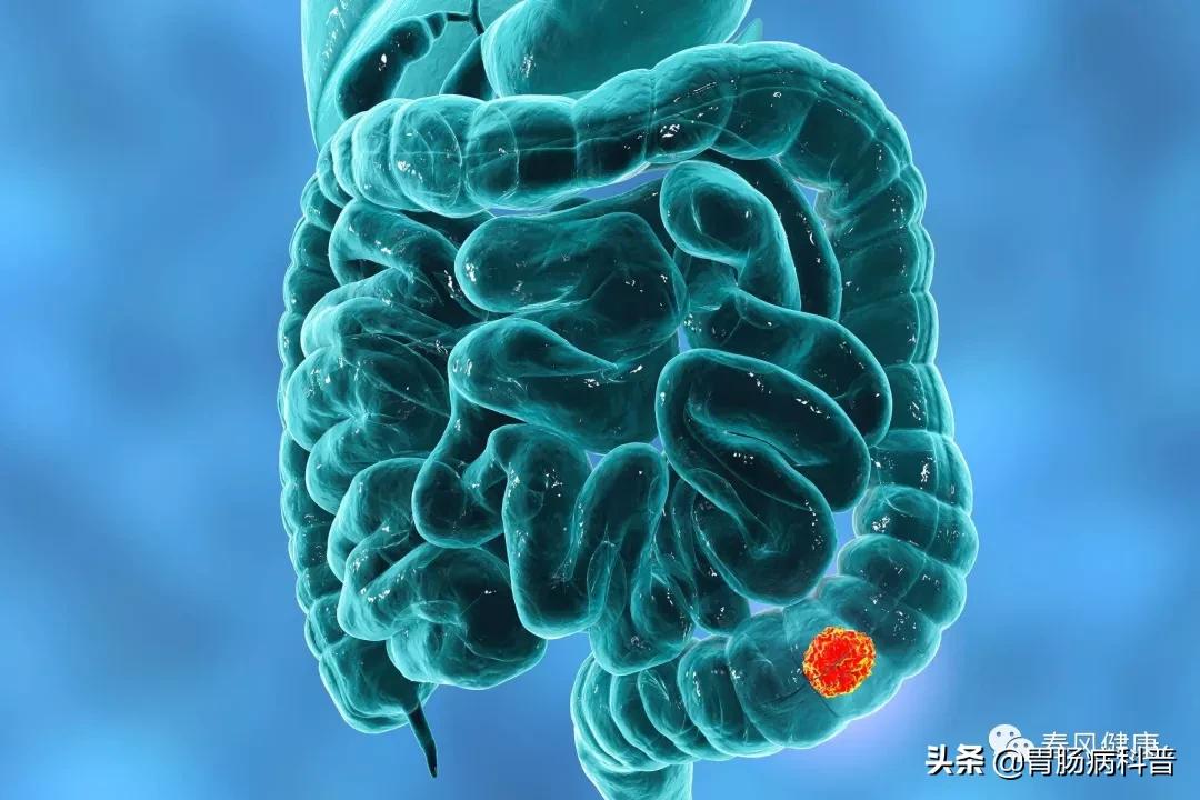 癌前病变虽不是癌症，但这8种情况一定别轻视