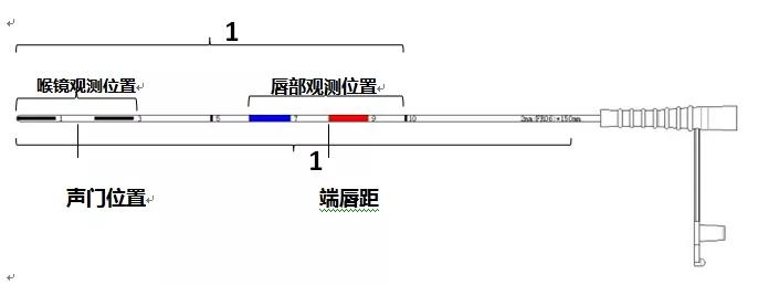守护生命的奇迹|聊城市二院新生儿科率先成功开展LISA技术