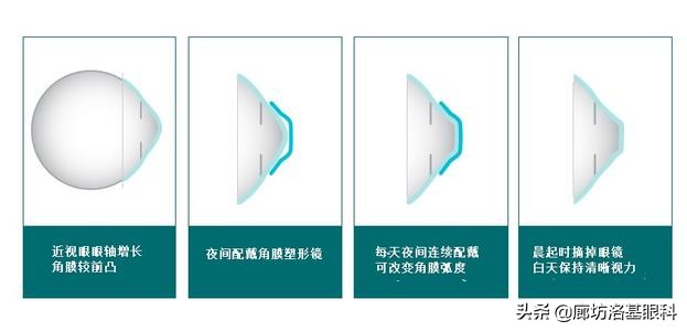 孩子近视了怎么办能治好吗,孩子近视了应该怎么治