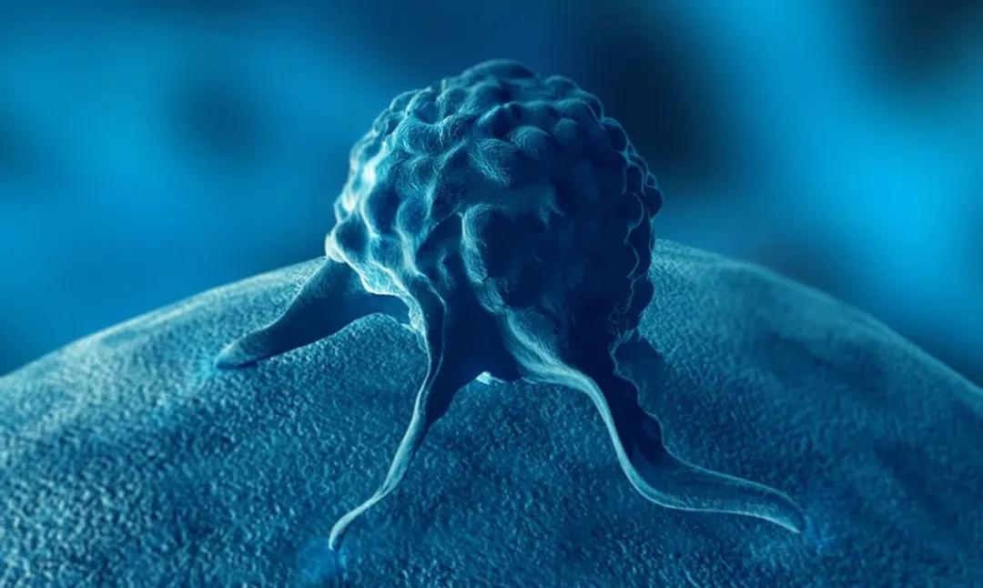 女性可能会遇到泌尿系统的问题,泌尿疾病应该怎么治疗女性