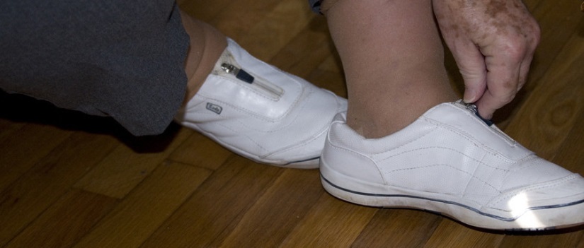 土豆消除老年斑最快方法男士,手上老年斑消除最好的方法