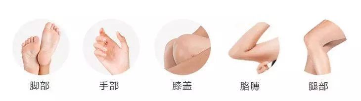 夏天了手脚干裂还有老茧,手脚干裂脱皮老茧用什么药膏