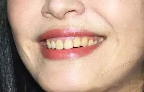 李佳琦一月变白秘籍,李佳琦的正确刷牙方法视频