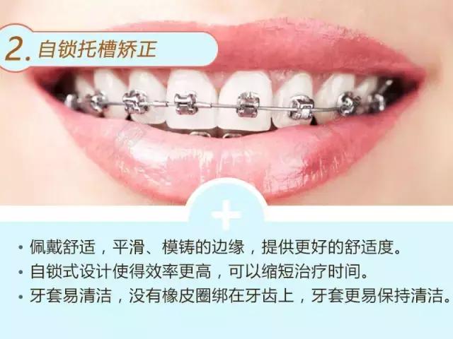 牙齿深覆合龅牙矫正过程,龅牙地包天怎么弄