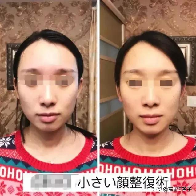 脸大真的不如脸小的好看吗,脸小真的显瘦吗