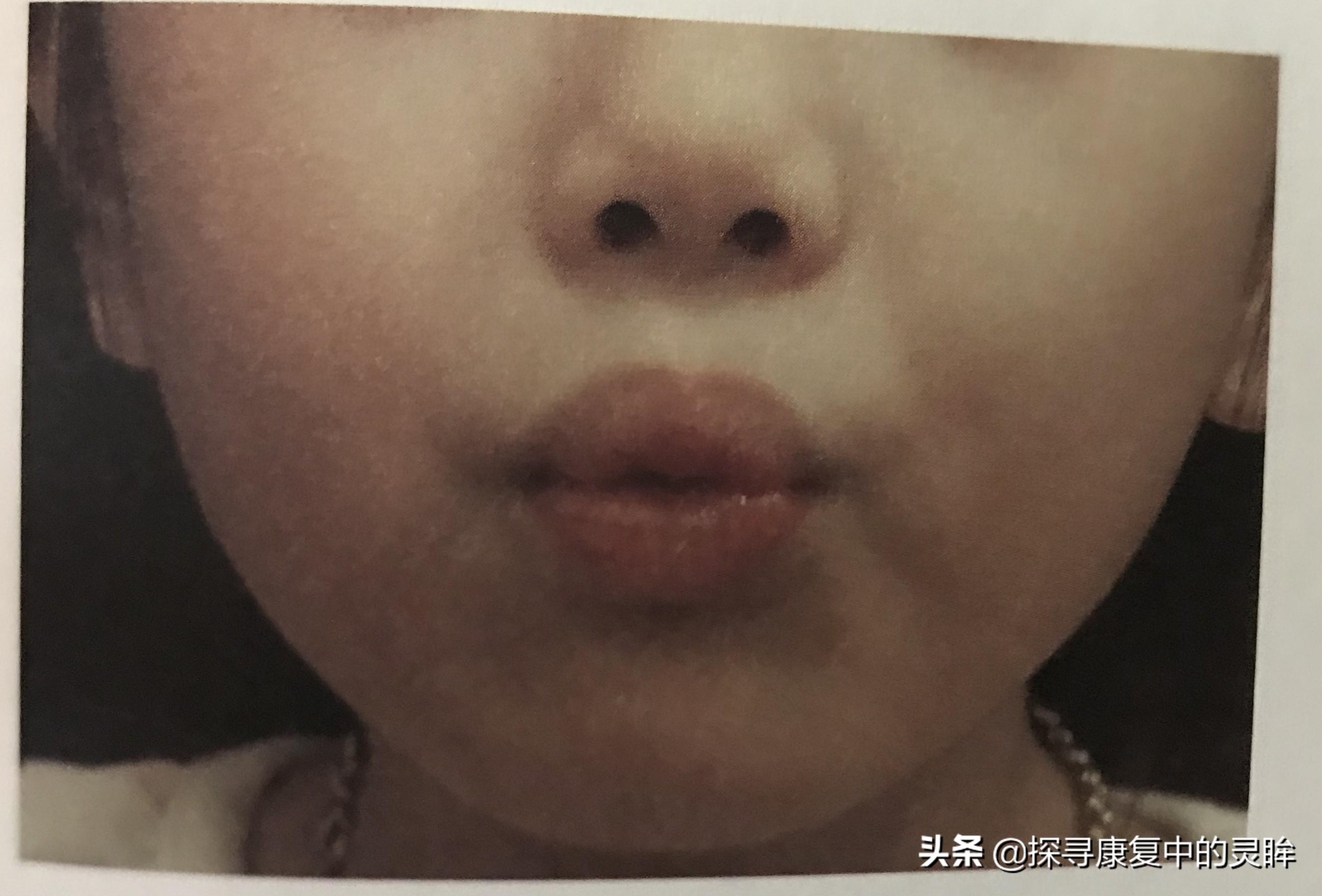 五种口部运动：灵活孩子的樱桃小嘴，让他们说话更清晰（超简单）