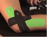 鹅趾肌腱滑囊炎还能跑步吗,跑步滑囊炎一般要休息多久