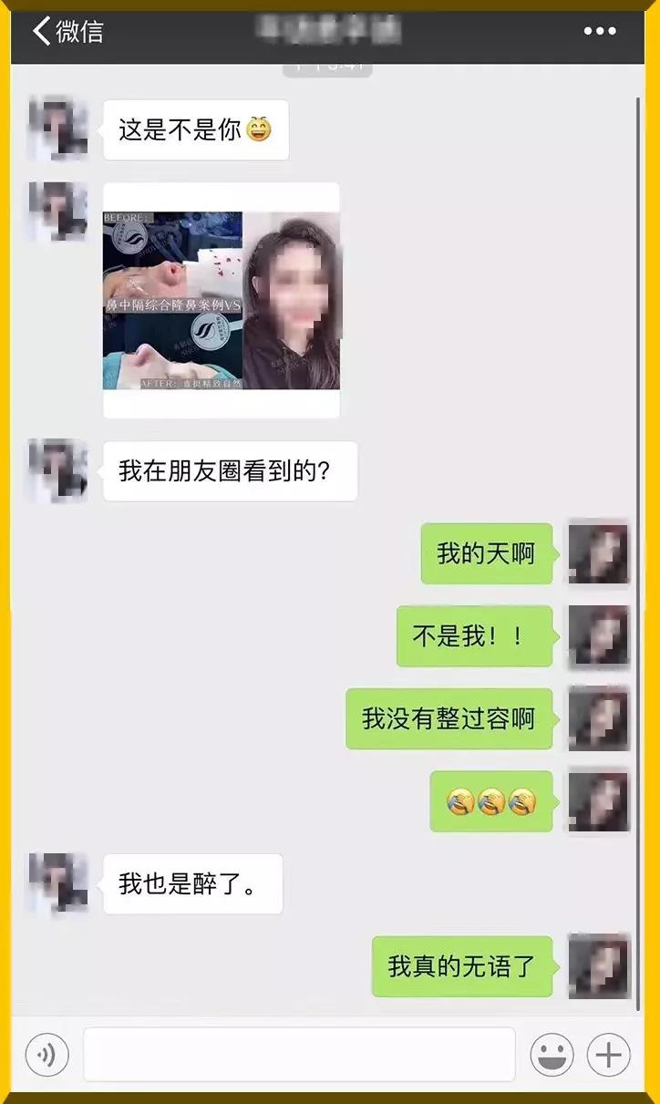 花了26万做整容手术,24岁女子花21万整容