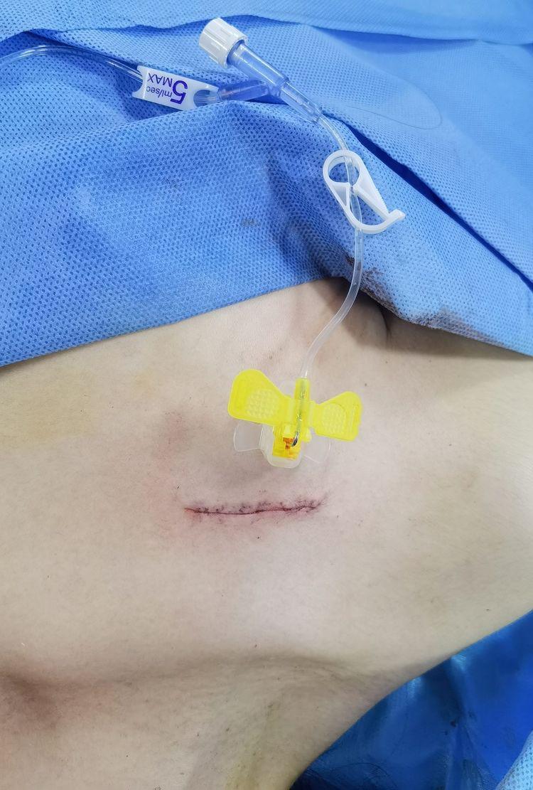 太原市中心医院汾东院区乳腺科,太原市中心医院乳腺外科