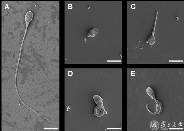 附属妇产科医院张锋课题组合作研究发现人类弱畸精子症的新致病基因TTC29